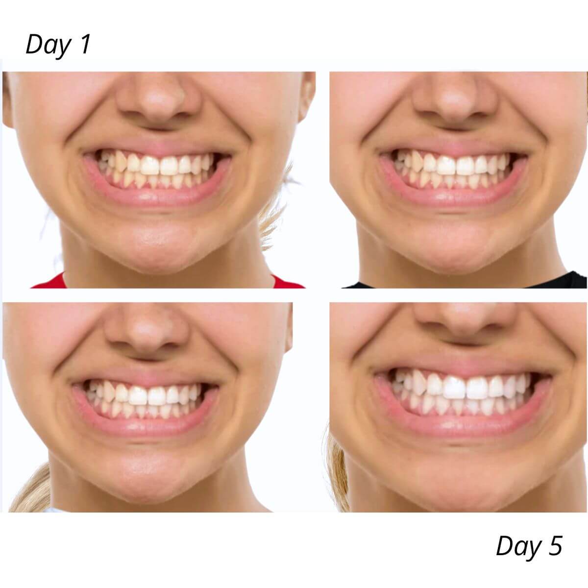 Shop All Teeth Whitening Products