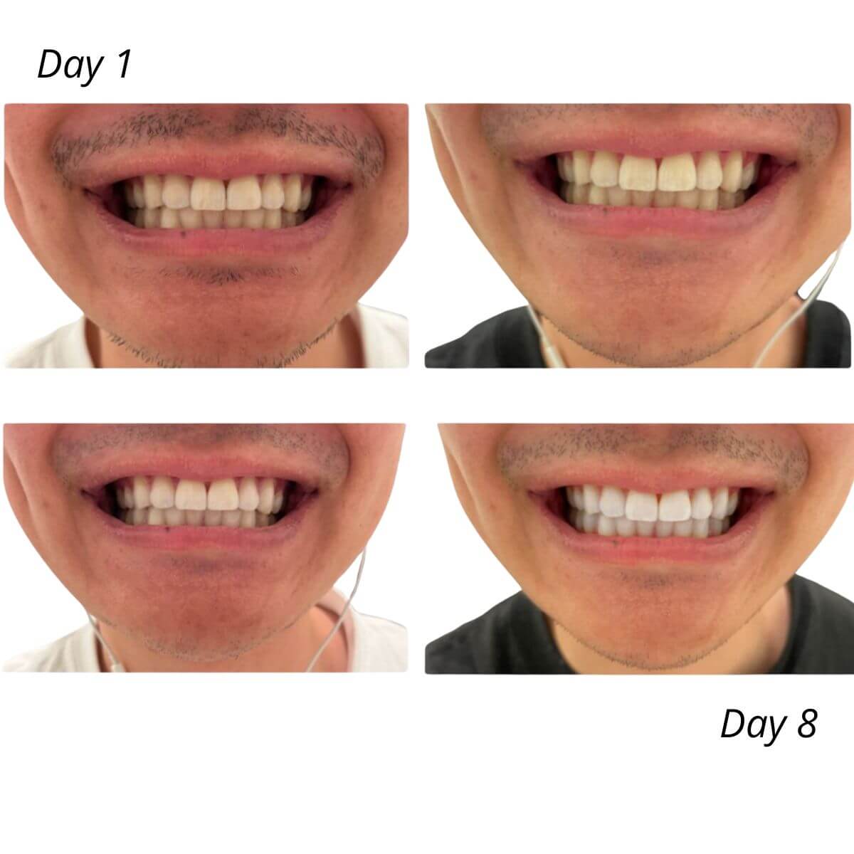 Expertwhite Teeth Whitening strips Expertwhite Smile Reset Strips