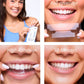 Expertwhite Teeth Whitening strips Expertwhite Smile Reset Strips