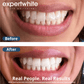 Expertwhite Teeth Whitening strips Max+ Instant Teeth Whitening Strips
Professional-Grade. Advanced Dry-Tech. No Slip. Stains Gone.