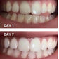 Expertwhite Teeth Whitening strips MaxStrips™ - Take Whitening Beyond the Surface.