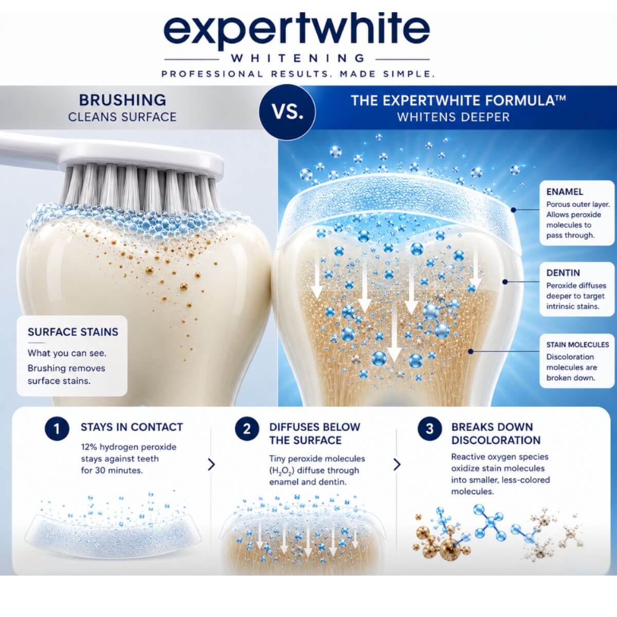Expertwhite Teeth Whitening strips THE WONDER STRIPS™ - with Matrix Technology - For a Blindingly White Smile.