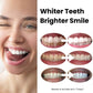 Expertwhite Teeth Whitening Trays Expertwhite FlexFit™ 12%HP Prefilled Teeth Whitening Trays