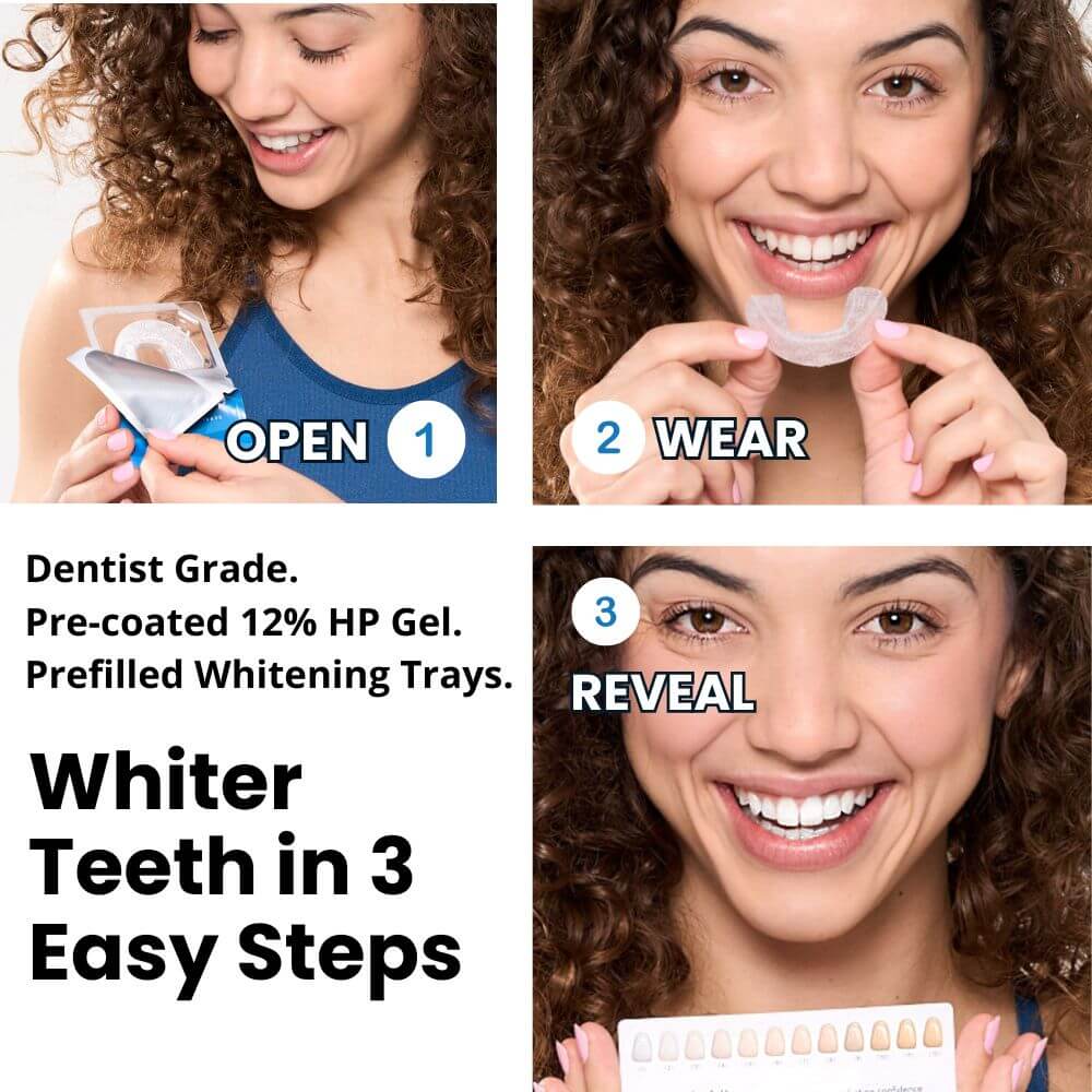 Expertwhite Teeth Whitening Trays Expertwhite FlexFit™ 12%HP Prefilled Teeth Whitening Trays