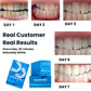 Expertwhite Teeth Whitening Trays Expertwhite FlexFit™ 12%HP Prefilled Teeth Whitening Trays