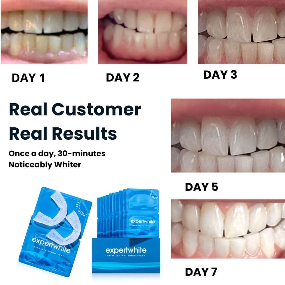 Expertwhite Teeth Whitening Trays Expertwhite FlexFit™ 12%HP Prefilled Teeth Whitening Trays
