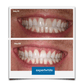 Expertwhite Teeth Whitening Trays Kit Expertwhite Max+ Prefilled Whitening Trays