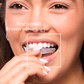 Expertwhite Teeth Whitening Trays Kit Expertwhite Max+ Trays: 12% HP Dentist-Grade Whitening Trays – Ready to Use