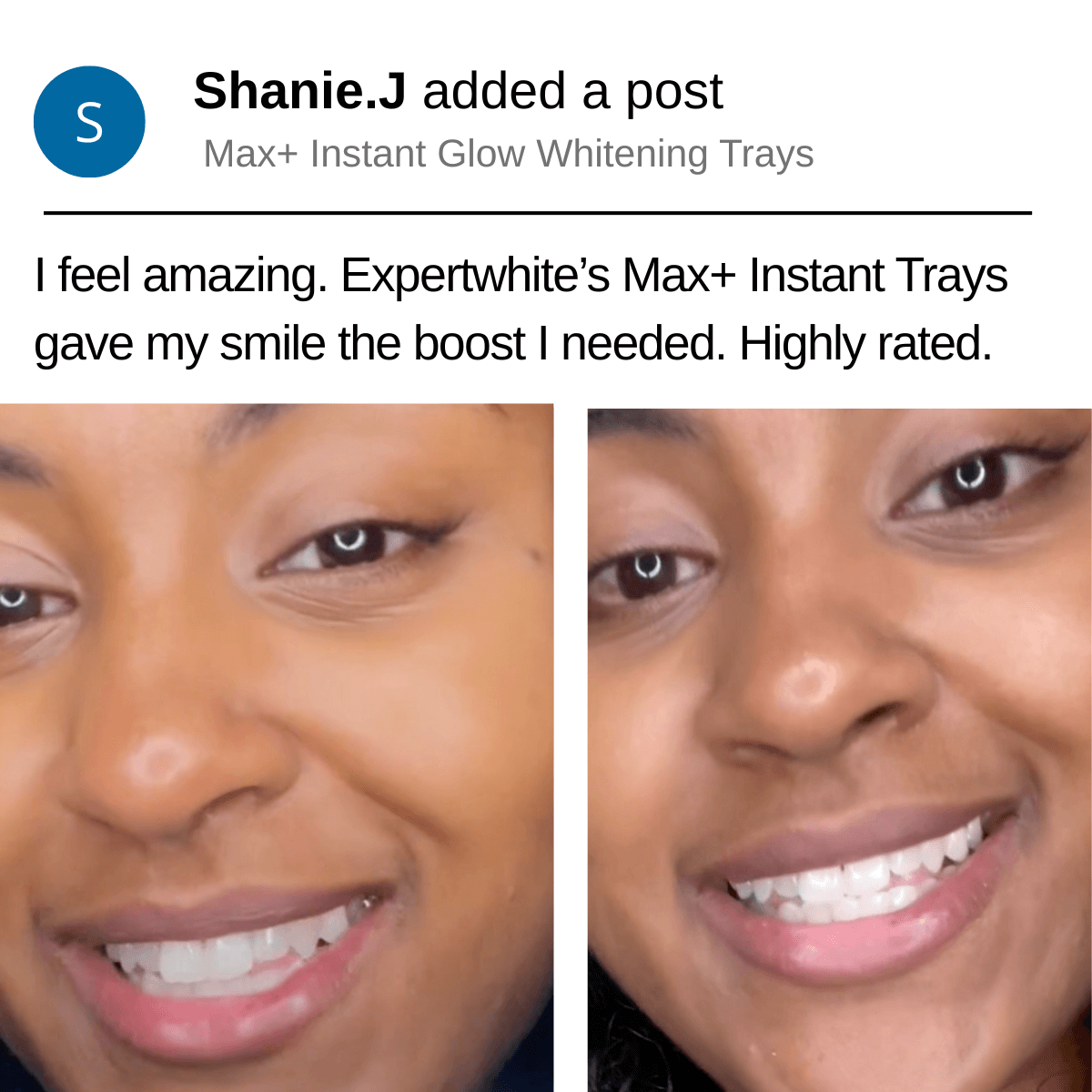Expertwhite Teeth Whitening Trays Kit Max+ Instant Glow Prefilled Whitening Trays