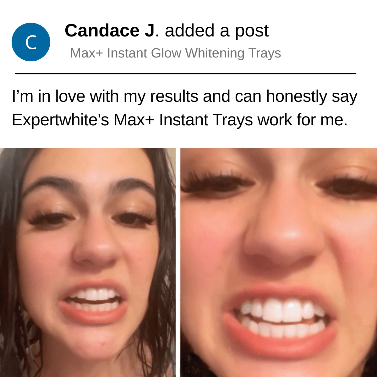 Expertwhite Teeth Whitening Trays Kit Max+ Instant Glow Prefilled Whitening Trays