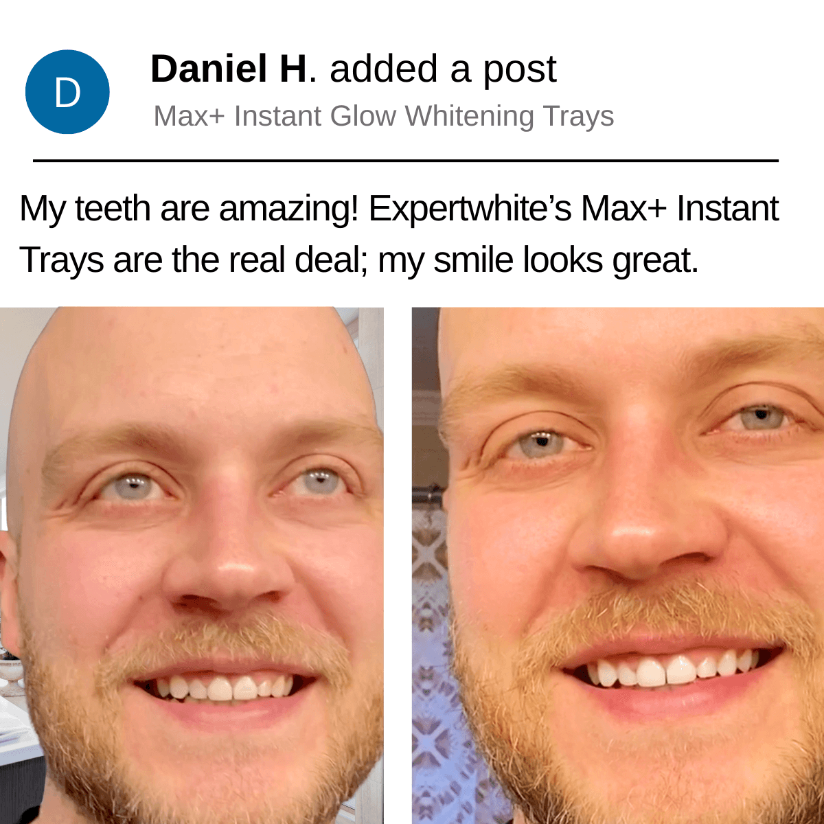 Expertwhite Teeth Whitening Trays Kit Max+ Instant Glow Prefilled Whitening Trays