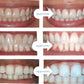 Expertwhite Teeth Whitening Trays Kit Teeth Whitening Trays – 35% Carbamide Peroxide, Preloaded Foam-Lined Gel for Close Contact Whitening