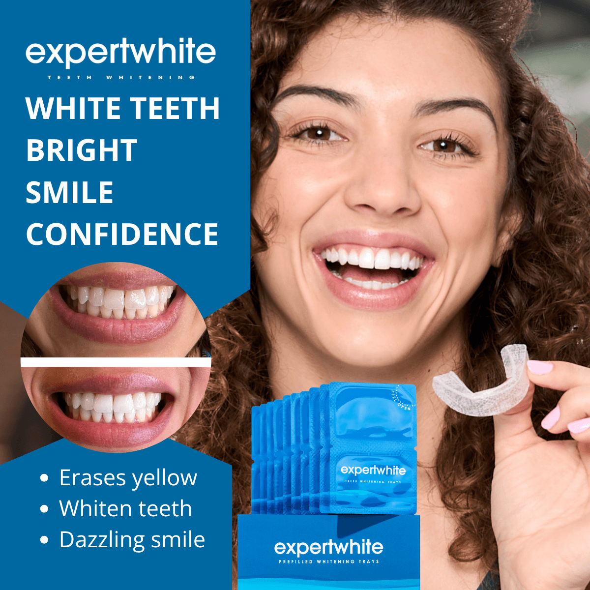 Expertwhite Max Glow Trays – 12HP Prefilled Whitening