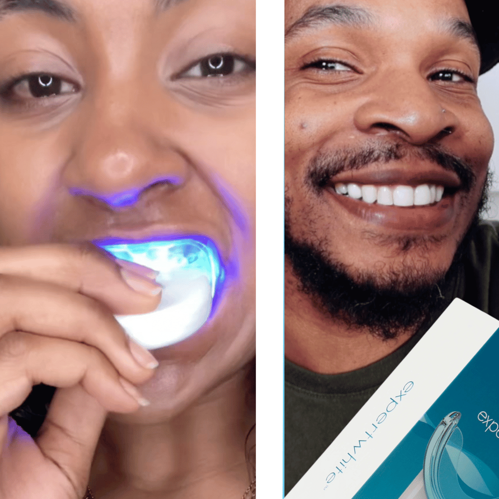 Expertwhite Teeth Whitening Kit Buy One, Get one 50% Off